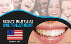 Bright White Smiles 44% Teeth Whitening Gel Syringe Refill Pack, Carbamide Peroxide, 5 Syringes (3ml),Tooth Whitener Formula