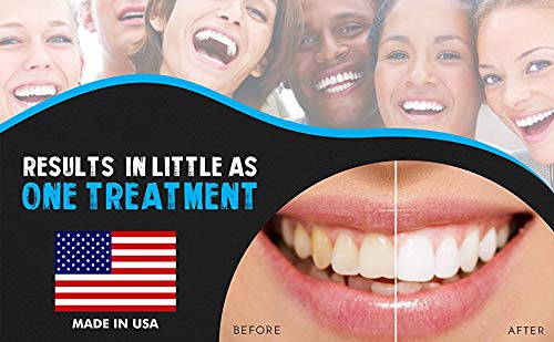 Bright White Smiles 44% Teeth Whitening Gel Syringe Refill Pack, Carbamide Peroxide, 5 Syringes (3ml),Tooth Whitener Formula