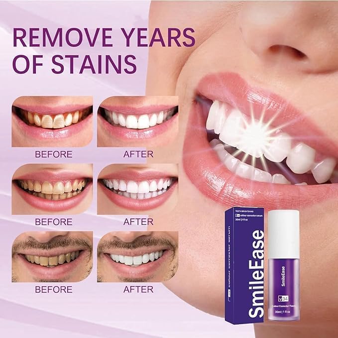 Purple Toothpaste for Teeth Whitening, Purple Whitening Toothpaste for Adults,Tooth Stain Remover Gel - Tooth Whitener Suitable for Smoking, Coffee, and Removing Dental Stone ﻿ ﻿ ﻿