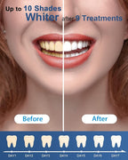 MySmile Teeth Whitening Gel Refills Pack, 6 Non-Sensitive Teeth Whitening Gel Pen, Teeth Whitener Dental Grade Tooth Whitening Gel for Tray, 10 min Fast Result Whitening