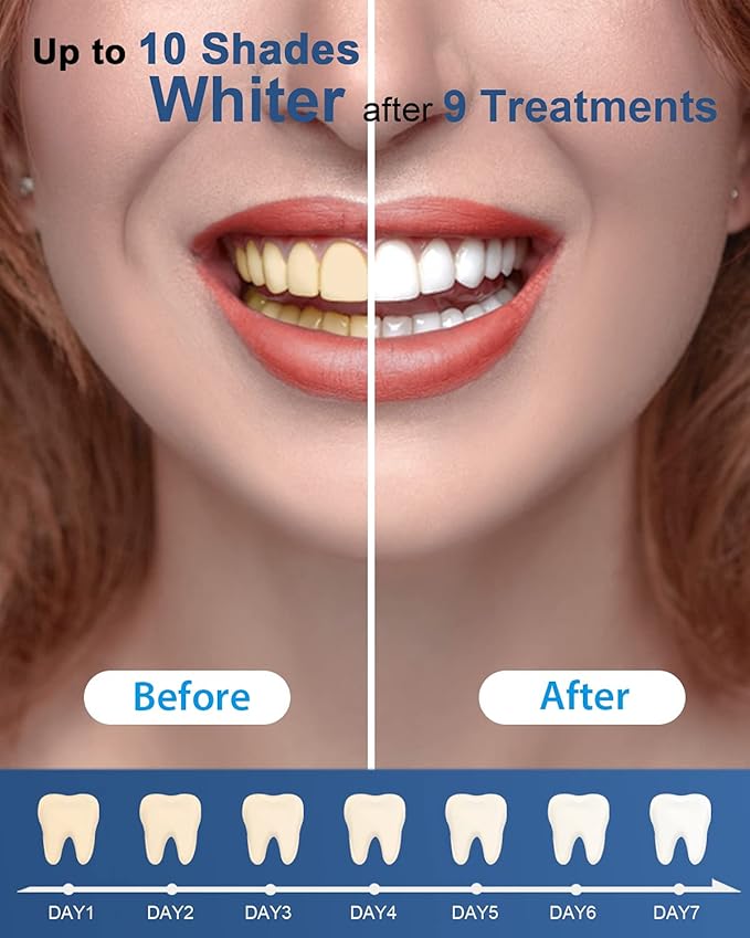 MySmile Teeth Whitening Gel Refills Pack, 6 Non-Sensitive Teeth Whitening Gel Pen, Teeth Whitener Dental Grade Tooth Whitening Gel for Tray, 10 min Fast Result Whitening