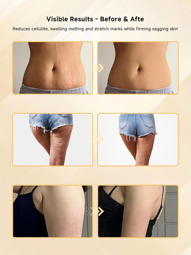 Body Sculpting Machine, Lymphatic Drainage Massager & Anti Cellulite Massage Tool, Helps Reduce Stretch Marks & Cellulite, Pain Relief Devices for Sciatica Nerve, Legs, Arms, Hip, Muscle & Lower Back