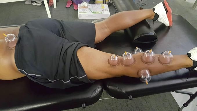 MUCHOO Cupping Set Professional Chinese Acupoint Cupping Therapy Sets Portable, Suction Hijama Cupping Set with Vacuum Magnetic Pump Cellulite Cupping Massage Kit 22-Cup