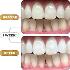 Lumineux Ultimate Whitening Kit Bundle - Contains Toothpaste, Mouthwash, Strips and Whitening Pen - Enamel Safe and Clinically Proven to Whiten Without The Sensitivity - Removes Coffee and Tea Stains