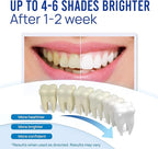 VieBeauti Teeth Whitening Pen (4 Pcs), 40+ Uses, Effective, Painless, No Sensitivity, Travel-Friendly, Easy to Use, Beautiful White Smile, Mint Flavor