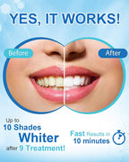 MySmile Non-Sensitive Teeth Whitening Pen Mint Gel Enamel Safety 8ML 30+ Treatments Fast Remove 20 Years of Stains Care Oral Bright Smile Alternative Teeth Whitening Strips ﻿