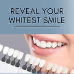 Teeth Whitening Gel Refill for Trays - Professional Strength 44% Carbamide Peroxide Formula - Fast & Effective Bleaching Solution for a Brighter Smile