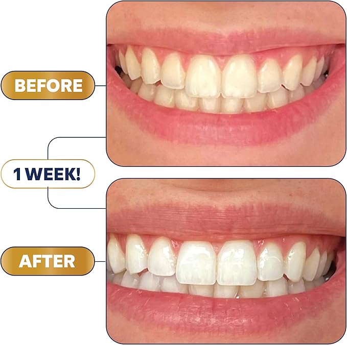 Lumineux Teeth Whitening Strips 9 Treatments – Peroxide Free - Enamel Safe for Whiter Teeth - Whitening Without The Sensitivity - Dentist Formulated - Sensitivity Free