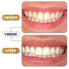 Lumineux 2-in-1 Whitening Pen (1 Pack) Enamel Safe and Clinically Proven to Whiten Without The Sensitivity - Removes Coffee, Tea, and Smoking Stains