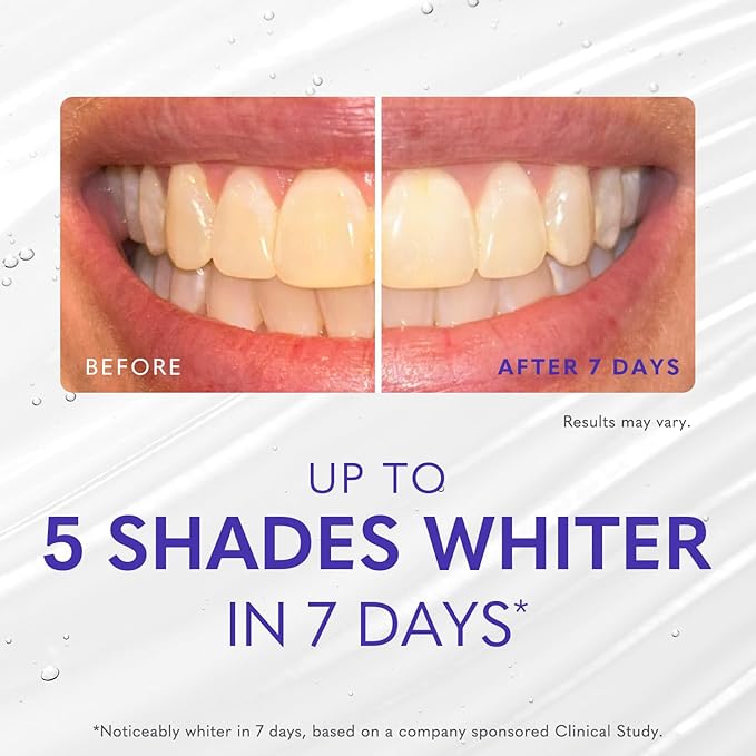 Smileactives Teeth Whitening Gel for Toothpaste with Clinical-Grade Hydrogen Peroxide, Tooth Stain Remover for White Teeth, Dentist Quality Pro Whitening Gel to Remove Stains, 90 Day, 3.8 oz Bottle