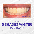 Smileactives Teeth Whitening Gel for Toothpaste with Clinical-Grade Hydrogen Peroxide, Tooth Stain Remover for White Teeth, Dentist Quality Pro Whitening Gel to Remove Coffee Stains, 2 oz Bottle