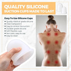 TrelaCo 12 Pcs 2 Size Cupping Therapy Set Silicone Anti Cellulite Cupping Kit for Massage Therapy Cupping Therapy Set Vacuum Suction Cup for Arthritis Relief, Pain Reduction Adults Home Use (White)