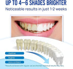 Teeth Whitening Pen Gel Kit: 35% Carbamide Peroxide Gel for Stain Removal - No Sensitivity with Remineralizing Pen for a Brighter Whiter Smile Mint