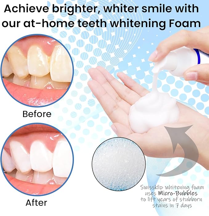 Swissklip Teeth Whitening Foam Toothpaste Also a Teeth Whitener in The Market I We Offer Best Teeth Whitening Products for Professional Teeth Whitening Kit (2)