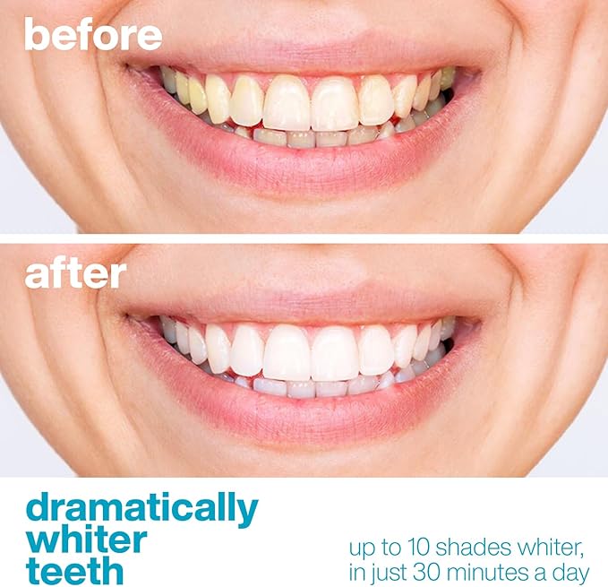 AquaSonic Professional Teeth Whitening Strips - Enamel Safe Teeth Whitening with Hydrogen Peroxide - Easy to Use, Non-Slip, Affordable & Effective (Unflavored)