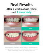 Live Orals Whitening Toothpaste 80g - Fluoride-Free Stain Removal, Strengthens Enamel, Natural Ingredients, Fresh Mint Flavor