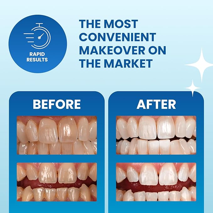 POOOF! Dissolving Teeth Whitening Strips by Dr. Bill Dorfman | 12% Hydrogen Peroxide | No-Slip Melt-Away Advanced Seal | Fast Stain Removal | Enamel & Sensitive Safe | 20 Ct (10-Day) | Polar Mint