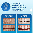 POOOF! Dissolving Teeth Whitening Strips by Dr. Bill Dorfman | 12% Hydrogen Peroxide | No-Slip Melt-Away Advanced Seal | Fast Stain Removal | Enamel & Sensitive Safe | 20 Ct (10-Day) | Polar Mint