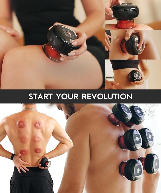 REVO The Original 4-in-1 Smart Cupping Therapy Massager, Red Light Therapy for Targeted Pain Relief, Knots, Aches, Muscle Soreness, Circulation & Tighter Skin, Portable Cupping Kit
