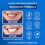 Whitening Strips for Sensitive Teeth 7 Treatments, Mint – Enamel Safe, Peroxide-Free Coconut Teeth Whitening Strips with Natural Enzymes – Gentle White Stips for Sensitive Gums & Daily Oral Care