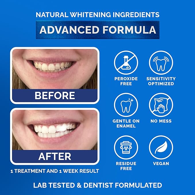 Whitening Strips for Sensitive Teeth 21 Treatments, Mint – Enamel Safe, Peroxide-Free Coconut Teeth Whitening Strips with Natural Enzymes – Gentle White Stips for Sensitive Gums & Daily Oral Care