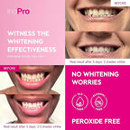 Teeth Whitening Strips 14 Treatments Kit - Teeth Whitener, Peroxide Free, Enamel Safe Green White Strips, Deep Stains Removal - Instant Teeth Whitening Without The Harm (28 Strips)