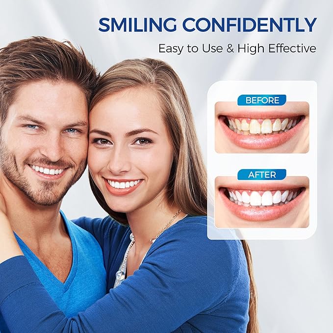 Teeth Whitening Kit for Sensitive Teeth,with 32X Waterproof LED Accelerator Light&4 Carbamide Peroxide Pen&14 Pcs Teeth Whitening Strips&1 Remineralization Pen,Tooth Whitener Professional Oral Care
