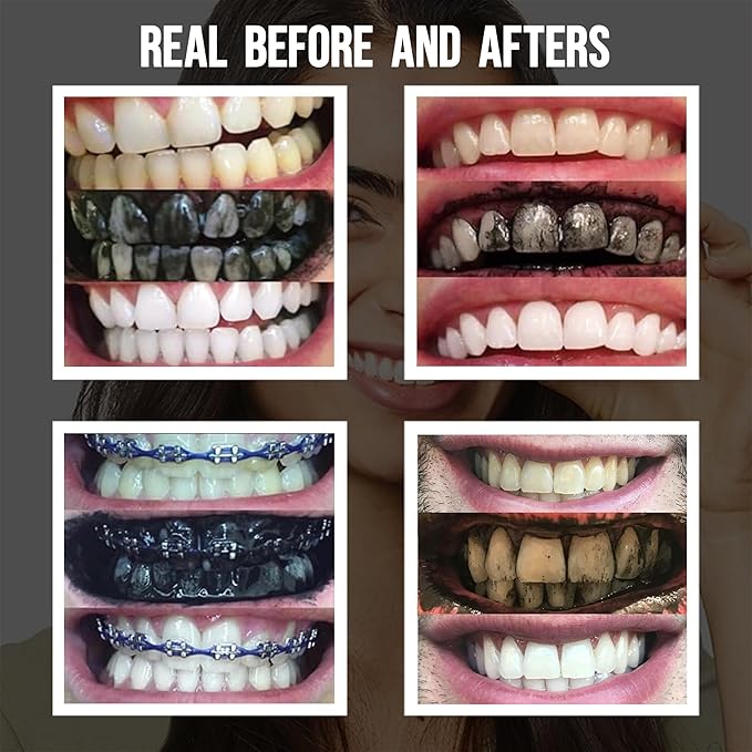 Premium Activated Charcoal Natural Coconut Teeth Whitening Powder - Safe for Enamel to get a Whiter and Brighter Smile - Organic Toothpaste Detoxifier