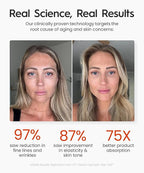 REVO Genie | Face & Neck Beauty Massager with Ultra Powerful LEDs for Wrinkles, Fine Lines, Puffy Skin, Uneven Skin Tone, Lymphatic Drainage, Lifting & Firming Facial Sculpting Tool with Light Therapy