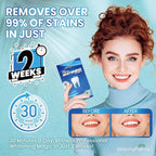 Professional Whitening Strips for Sensitive Teeth:Hydrogen Peroxide-Free Treatments - Effective & Gentle Dental Whitener (42 Count (Pack of 1), Mint)