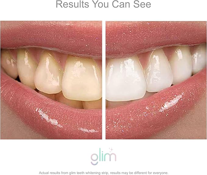 Glim Professional Teeth Whitening Strips| 42 Strips (21 Treatments), Hydrogen-Free, Peroxide-Free, Non-Toxic, Dentist Recommended, Sensitivity Free - Vegan & Cruelty Free - (Mint)