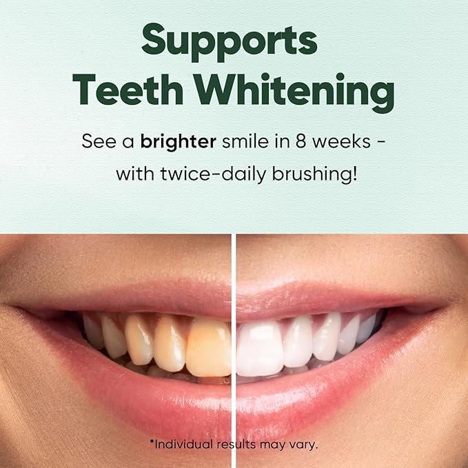MySmile Fluoride Free Toothpaste, Nano Hydroxyapatite Toothpaste for Sensitive Teeth, Strengthens Enamel, Remineralizes & Whitens Teeth, Freshens Breath for Adults, SLS Free, Natural Misty Mint, 4.2oz
