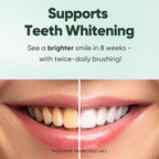 MySmile Fluoride Free Toothpaste, Nano Hydroxyapatite Toothpaste for Sensitive Teeth, Strengthens Enamel, Remineralizes & Whitens Teeth, Freshens Breath for Adults, SLS Free, Natural Misty Mint, 4.2oz