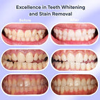 American Teeth Whitening Kit, Teeth Whitening Gel, Pen, Whitening Trays with Light, 25 Uses, Whiten Up to 8 Shades in 1 Week, 2025 Powerful Teeth Whitener