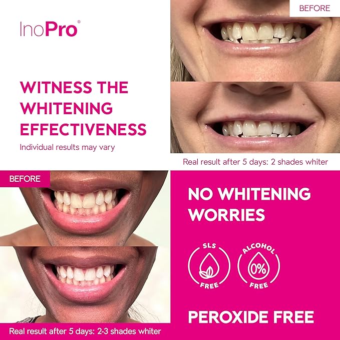 Teeth Whitening Strips 21 Treatments Kit - Teeth Whitener, Peroxide Free, Enamel Safe Green Whitestrips, Deep Stains Removal - Instant Teeth Whitening Without The Harm (42 Strips)