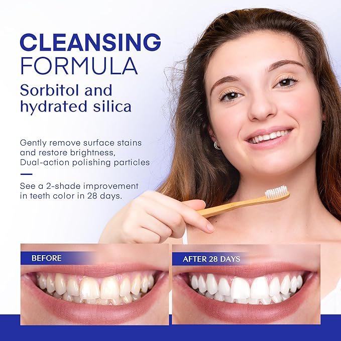 PearlSmile Hydroxyapatite Niacinamide Whitening Toothpaste – 5% Niacinamide + 10% Nano-Hydroxyapatite (nHAp) – Strengthens Enamel & Remineralizes – Fluoride-Free, 4.2oz (Pack of 3)